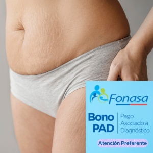 Drenaje Postoperatorio Abdominoplastia