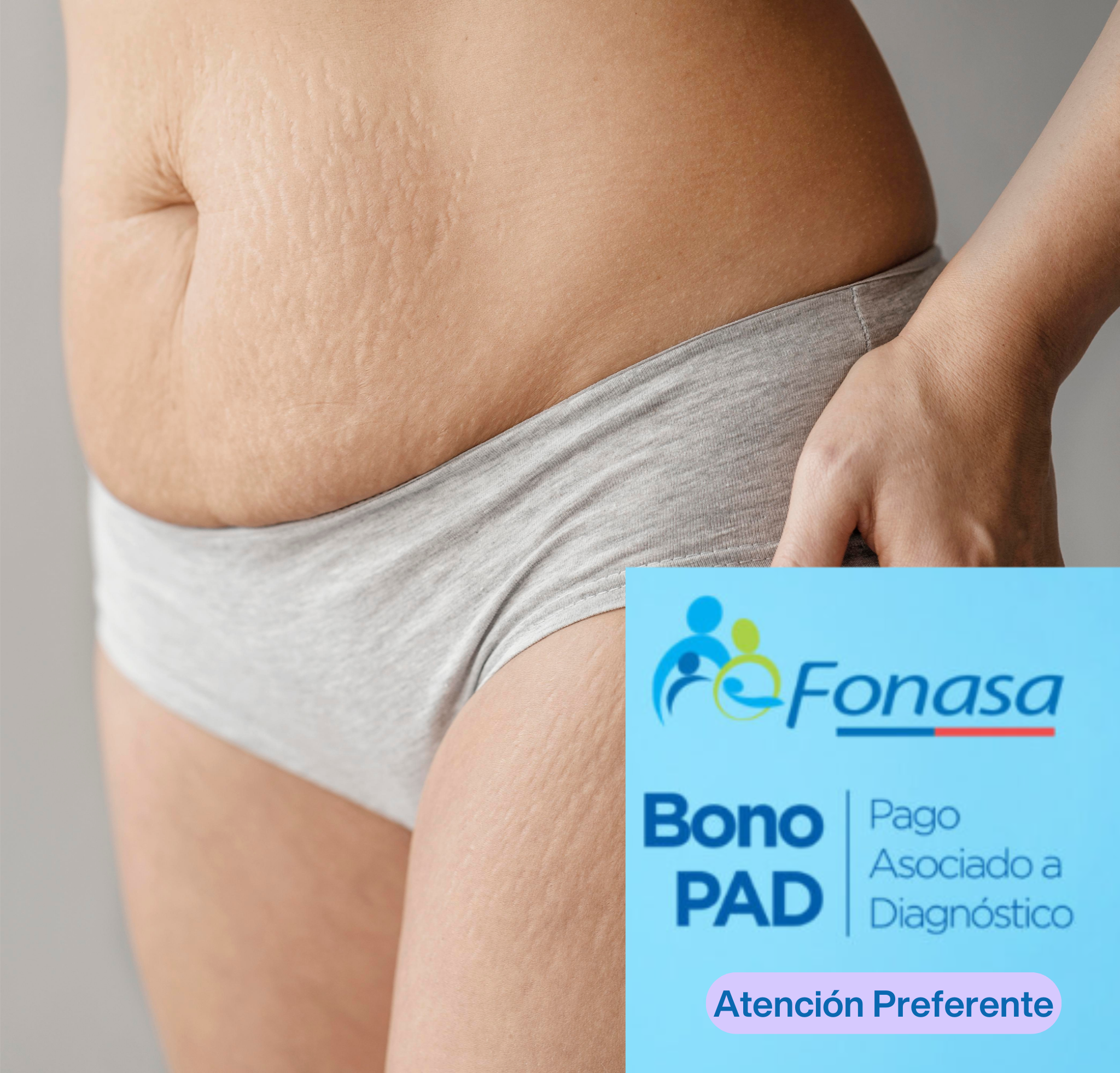 Drenaje Postoperatorio Abdominoplastia
